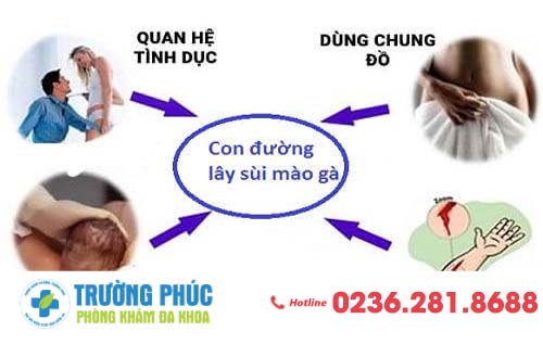Bệnh sùi mào gà lây qua những đường nào?