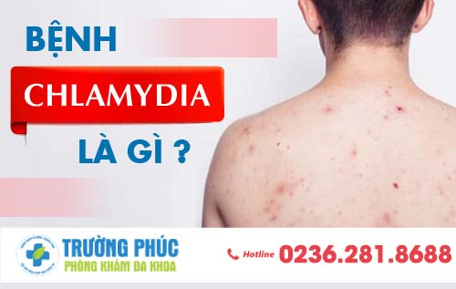 Bệnh Chlamydia là gì Có gây nguy hiểm không?