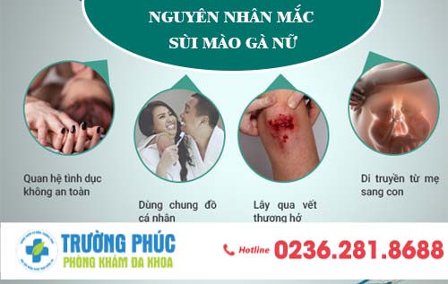 Sùi mào gà nữ: nguyên nhân mắc bệnh và cách chữa trị hiệu quả