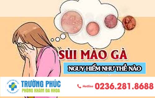 Sùi mào gà nguy hiểm như thế nào?