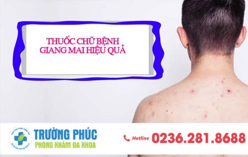 Thuốc chữa bệnh giang mai hiệu quả