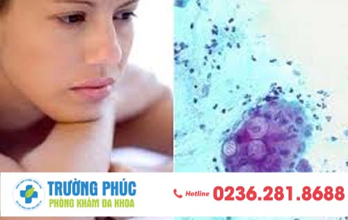 Triệu chứng nhận biết bệnh chlamydia và cách chữa trị