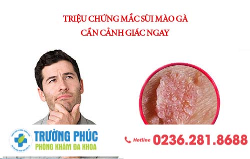 Triệu chứng mắc sùi mào gà cần phải cảnh giác ngay