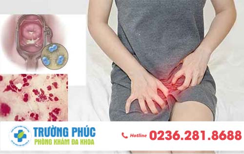 Âm đạo chảy mủ - dấu hiệu cảnh báo bệnh lậu