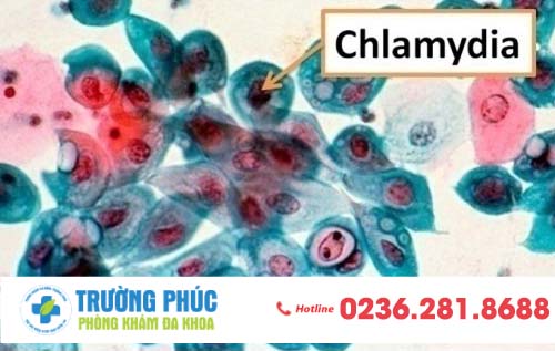 Những biến chứng thường gặp của bệnh chlamydia