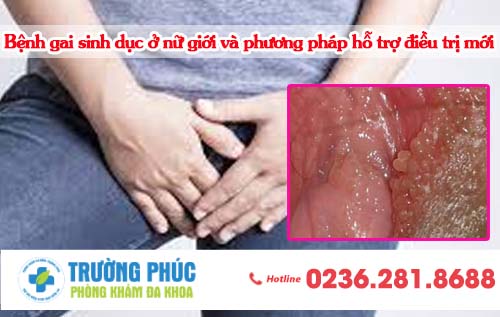 Bệnh gai sinh dục ở nữ giới và phương pháp hỗ trợ điều trị mới