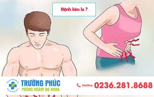Bệnh Kim La Và Những Thông Tin Không Phải Ai Cũng Biết