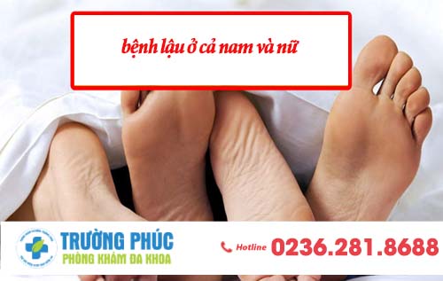 Hình ảnh bệnh lậu ở nam giới và nữ giới