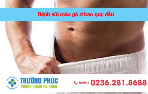 Bệnh sùi mào gà ở bao quy đầu