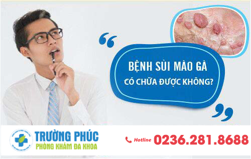 Bệnh sùi mào gà có chữa được không?