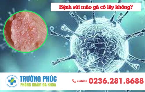 Bệnh sùi mào gà có lây không?