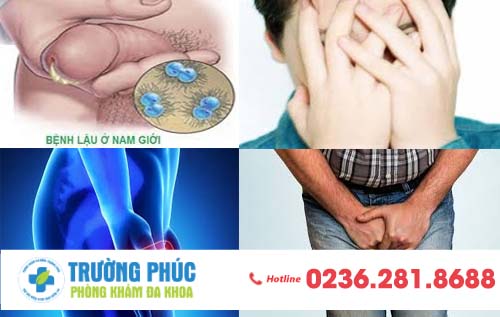 Bệnh lậu ở nam là bệnh gì và nhận biết như thế nào?