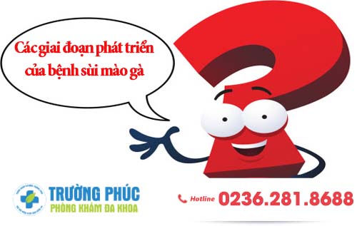 Các giai đoạn phát triển của bệnh sùi mào gà