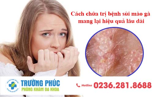 Cách chữa trị bệnh sùi mào gà mang lại hiệu quả lâu dài