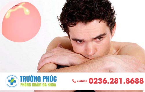 Dương Vật Chảy Mủ - Cẩn Thận Mắc Trọng Bệnh, Không Nên Chủ Quan