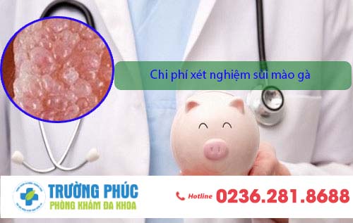 Chi phí xét nghiệm sùi mào gà là bao nhiêu? có đắt không?