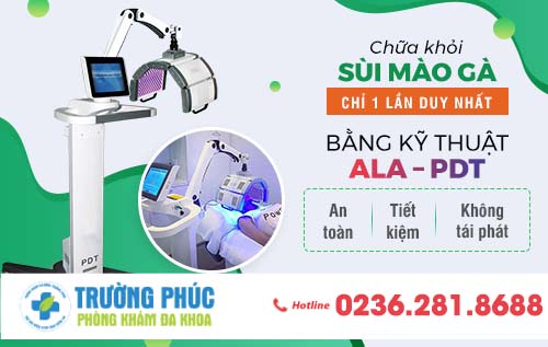 Bật mí những cách chữa sùi mào gà hay nhất hiện nay