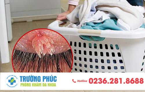 Nguy cơ nhiễm bệnh xã hội khi sử dụng đồ dùng cá nhân chung