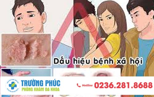 Dấu Hiệu Nhận Biết Bệnh Xã Hội Sớm Nhất