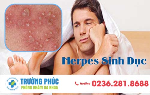 Herpes sinh dục có gây nguy hiểm không? và có chữa được không?