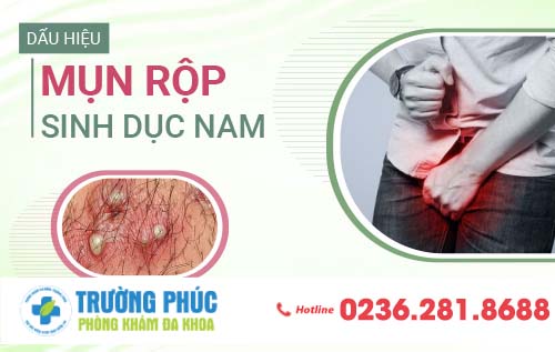 Mụn rộp sinh dục nam giới: Cách nhận biết và điều trị nhanh chóng