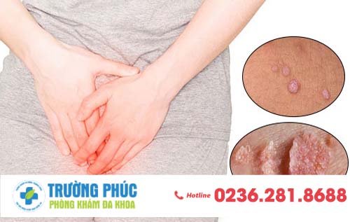 Dấu hiệu bệnh sùi mào gà mà bạn cần cảnh giác ngay