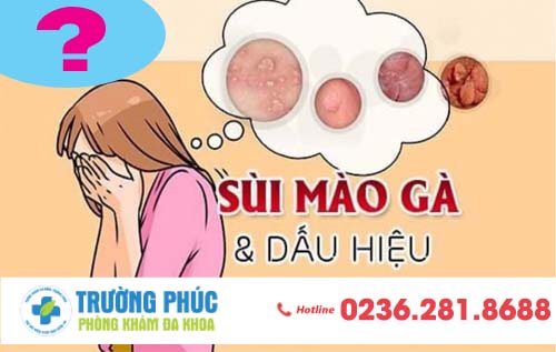 Dấu hiệu nhận biết đã mắc bệnh sùi mào gà