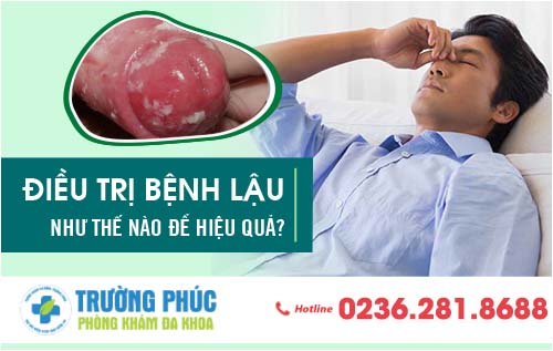 Điều trị bệnh lậu như thế nào để hiệu quả?