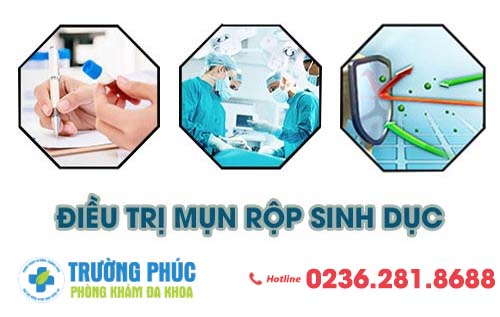 Biện pháp hỗ trợ điều trị mụn rộp sinh dục hiệu quả