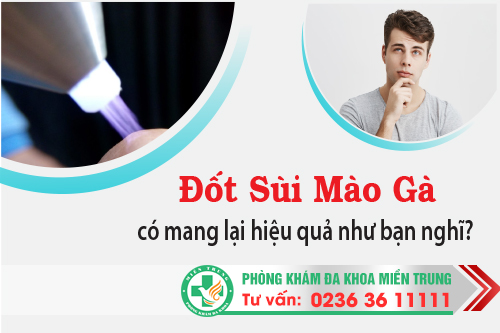 Đốt sùi mào gà có mang lại hiệu quả như bạn nghĩ?