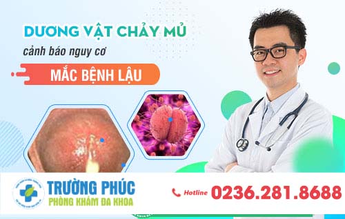 Dương vật chảy mủ cảnh báo nguy cơ mắc bệnh lậu