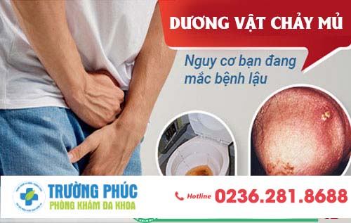 Dương vật chảy mủ ở nam giới - dấu hiệu không thể xem nhẹ