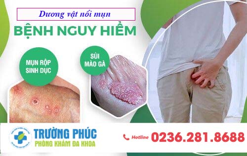Dương vật nổi mụn - nguyên nhân và cách điều trị hiệu quả