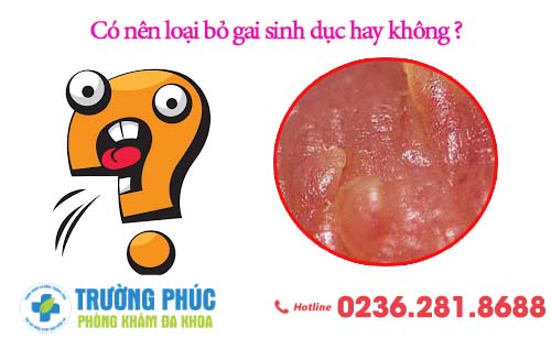 Có nên loại bỏ gai sinh dục hay không ?
