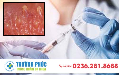 Gai sinh dục nữ có biểu hiện như thế nào? Có nguy hiểm không?
