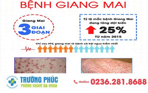 Bạn Đã Biết Đến Bệnh Tiêm La