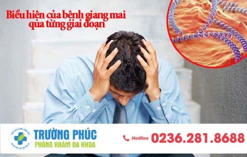 Biểu hiện của bệnh giang mai qua từng giai đoạn
