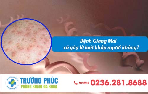 Bệnh Giang Mai có gây lở loét khắp người không?
