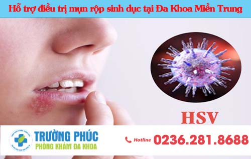 Hỗ trợ điều trị mụn rộp sinh dục tại Đa Khoa Trường Phúc