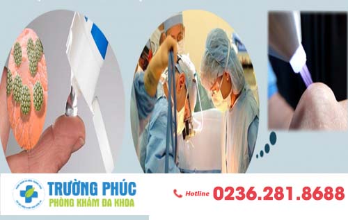 Hỗ trợ điều trị sùi mào gà bằng phương pháp nào hiệu quả?