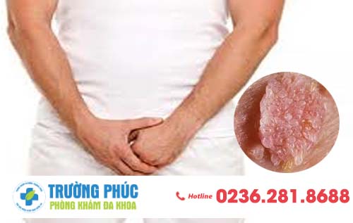 Nhiễm trùng Virus HPV gây ra những nguy hiểm nào?