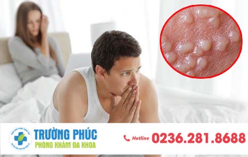 Dấu hiệu nhận biết bệnh mụn rộp sinh dục