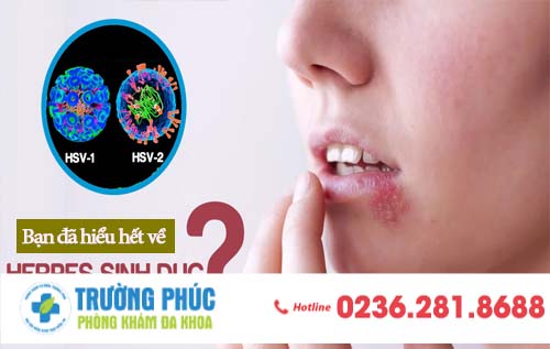 Bạn đã thật sự hiểu rõ về “mụn rộp sinh dục” ?