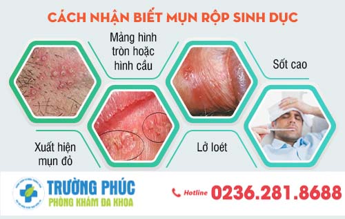 Mụn rộp sinh dục: nguyên nhân, triệu chứng và cách điều trị