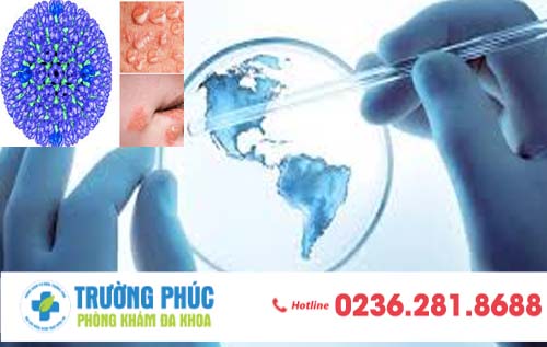 Tìm hiểu về mụn rộp sinh dục và phương pháp hỗ trợ điều trị