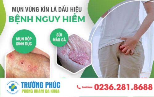 Mụn vùng kín dấu hiệu nguy hiểm cần cảnh giác cao độ