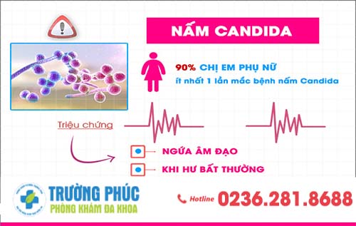 Nấm Candida – Căn Bệnh Nguy Hiểm Ở Cả Nam Và Nữ