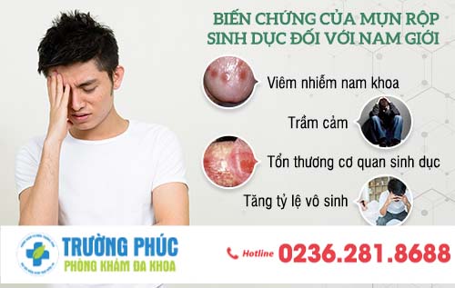 Nắm chắc “thời cơ” điều trị mụn rộp sinh dục nam thông qua những triệu chứng của bệnh