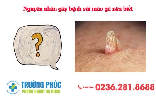 Nguyên nhân gây bệnh sùi mào gà nên biết