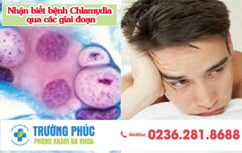 Nhận biết bệnh Chlamydia qua các giai đoạn